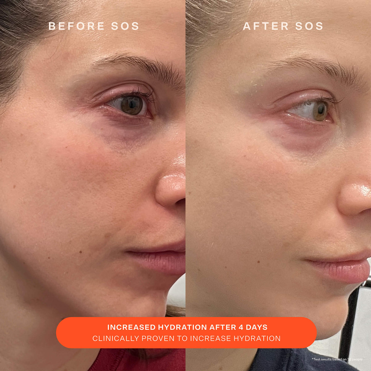 SOS Recovery Cream J8