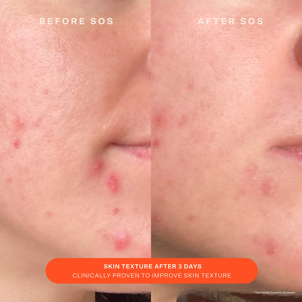 SOS Recovery Cream J8