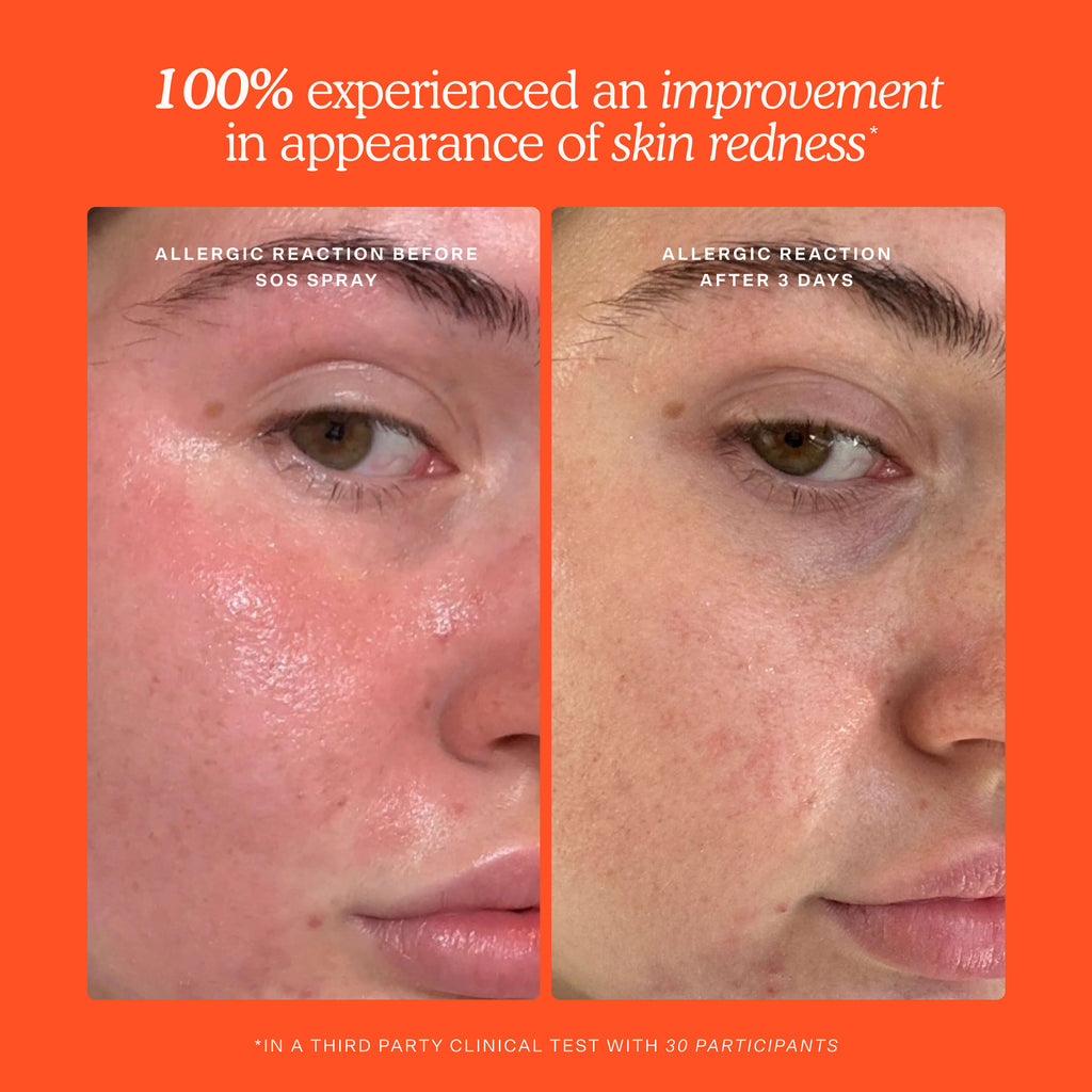 SOS 3-Step Skincare Set V9