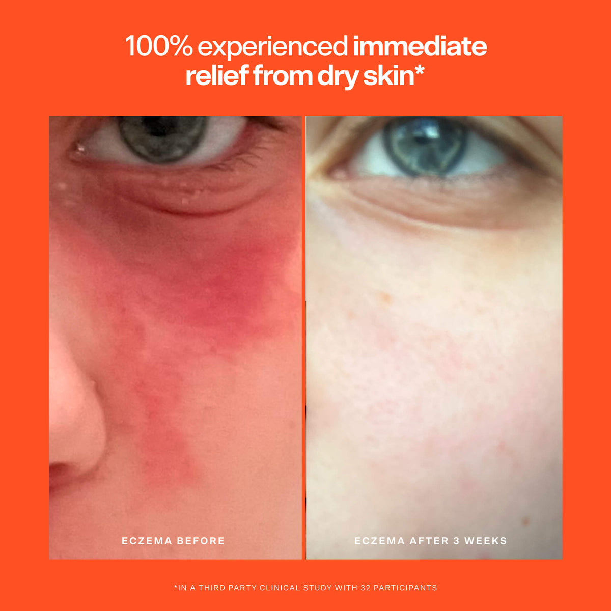 SOS Rescue Serum B5