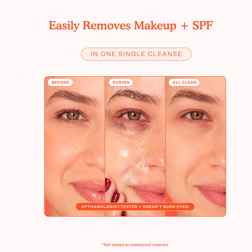 SOS Gel Cleanser Y2